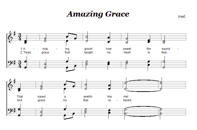 How to Arrange Music for Your Choir | Forte Notation